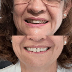 facetas 2